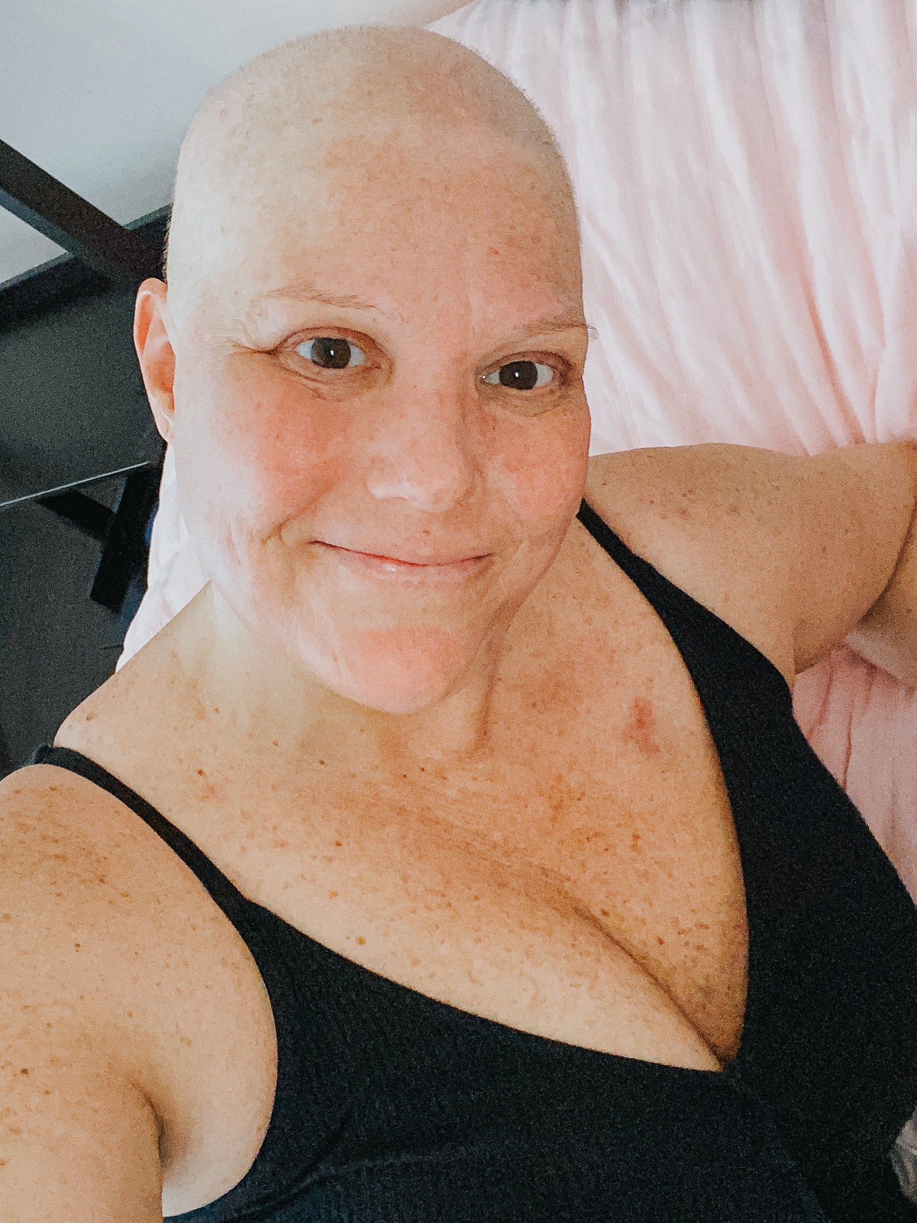 Coping With Chemotherapy Induced Hair Loss Warrior Sisters 